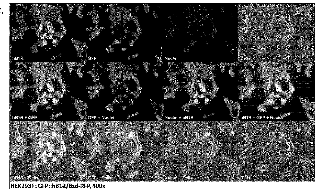 Compositions targeting bradykinin receptor B1 for medical imaging of cancer and other disorders