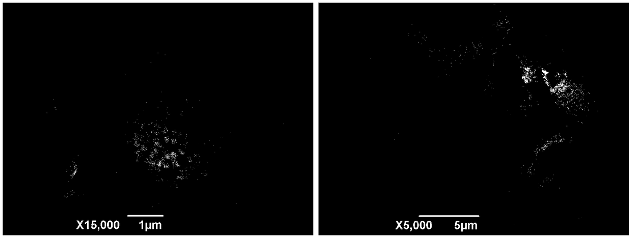 Preparation method of earthworm protein microsphere nano-trauma complex and application