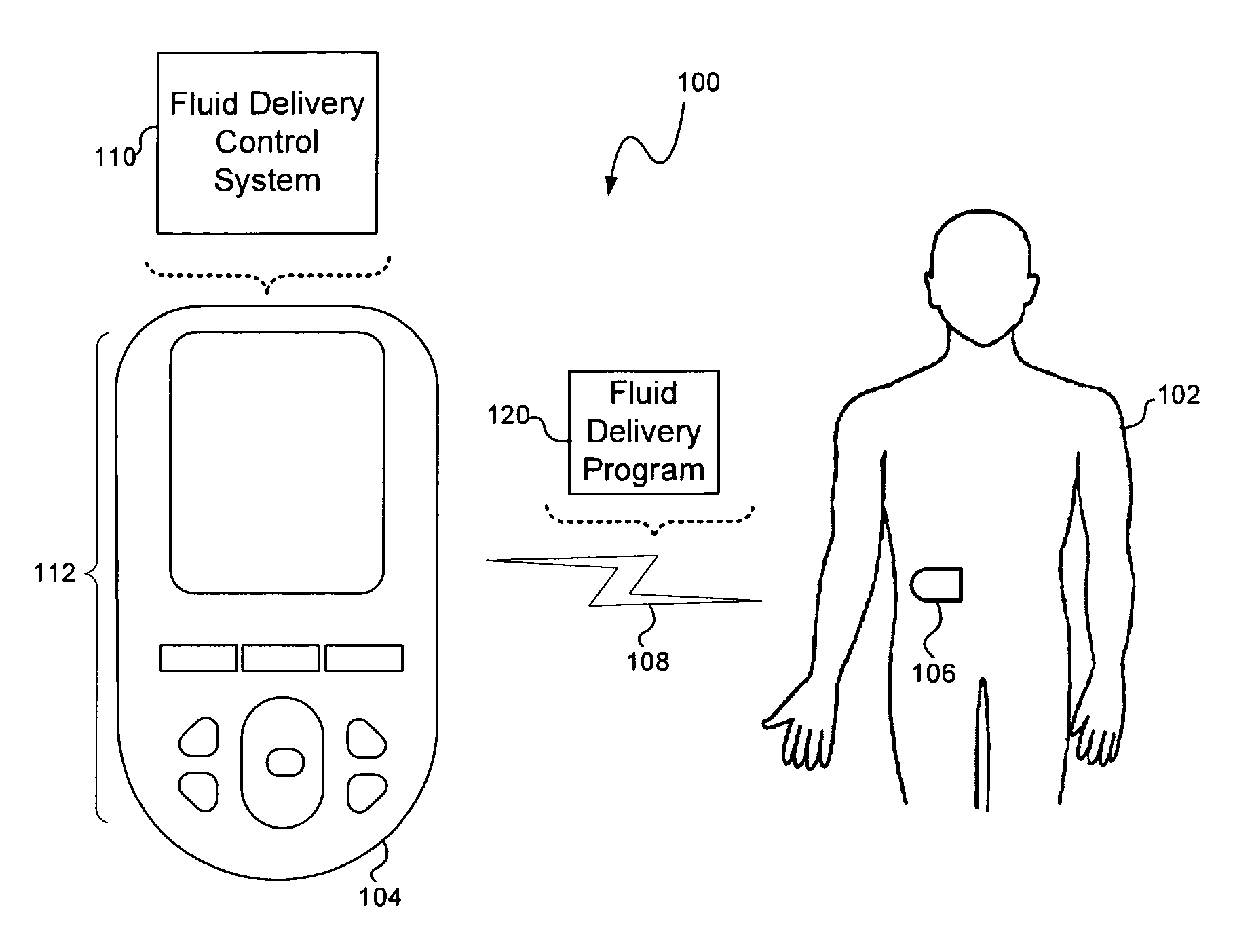 Calculating insulin on board for extended bolus being delivered by an insulin delivery device