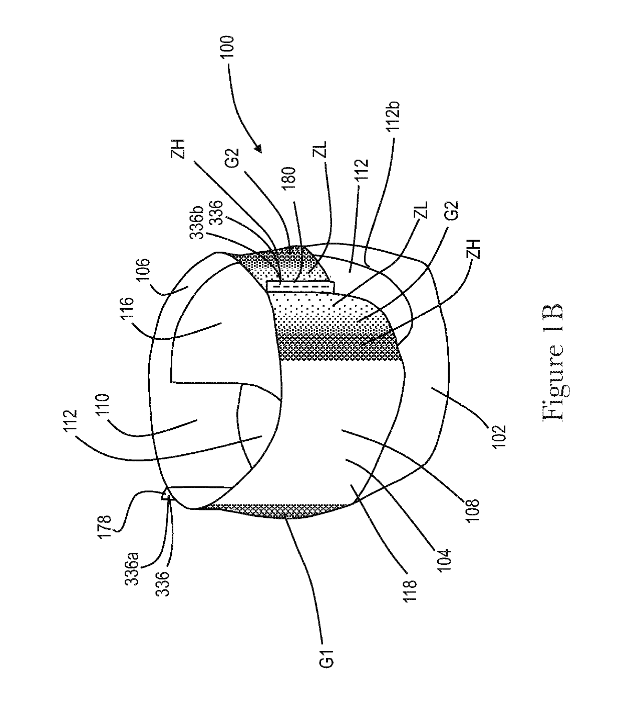 Apparatuses and methods for making absorbent articles with low intensity side seam regions