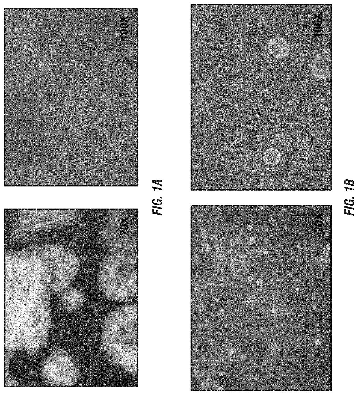 Macs-based purification of stem cell-derived retinal pigment epithelium
