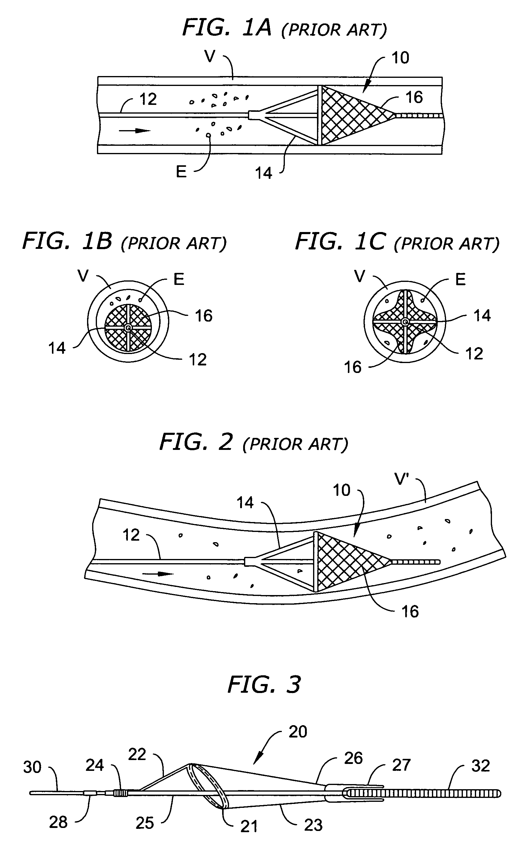 One piece loop and coil