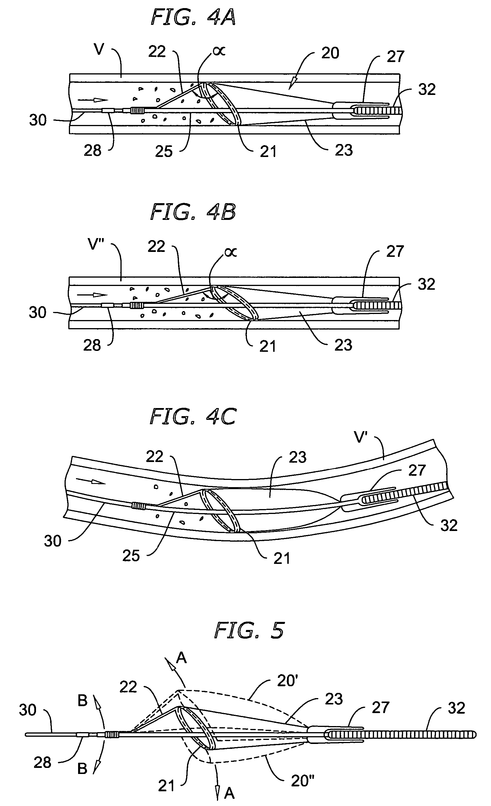 One piece loop and coil