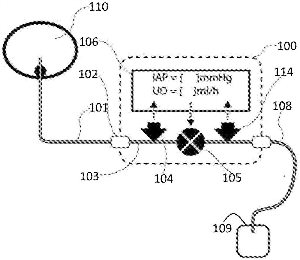 Apparatus and method of monitoring intra-abdominal pressure and urine output