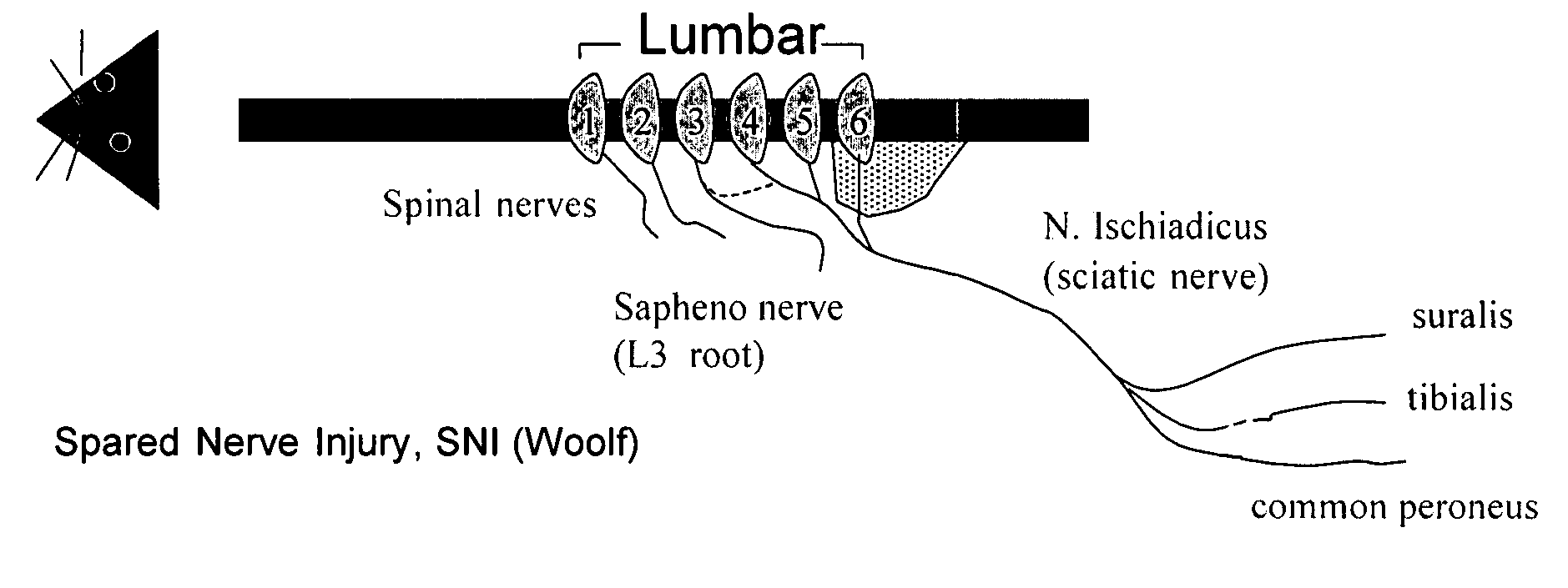 Methods of treating pain