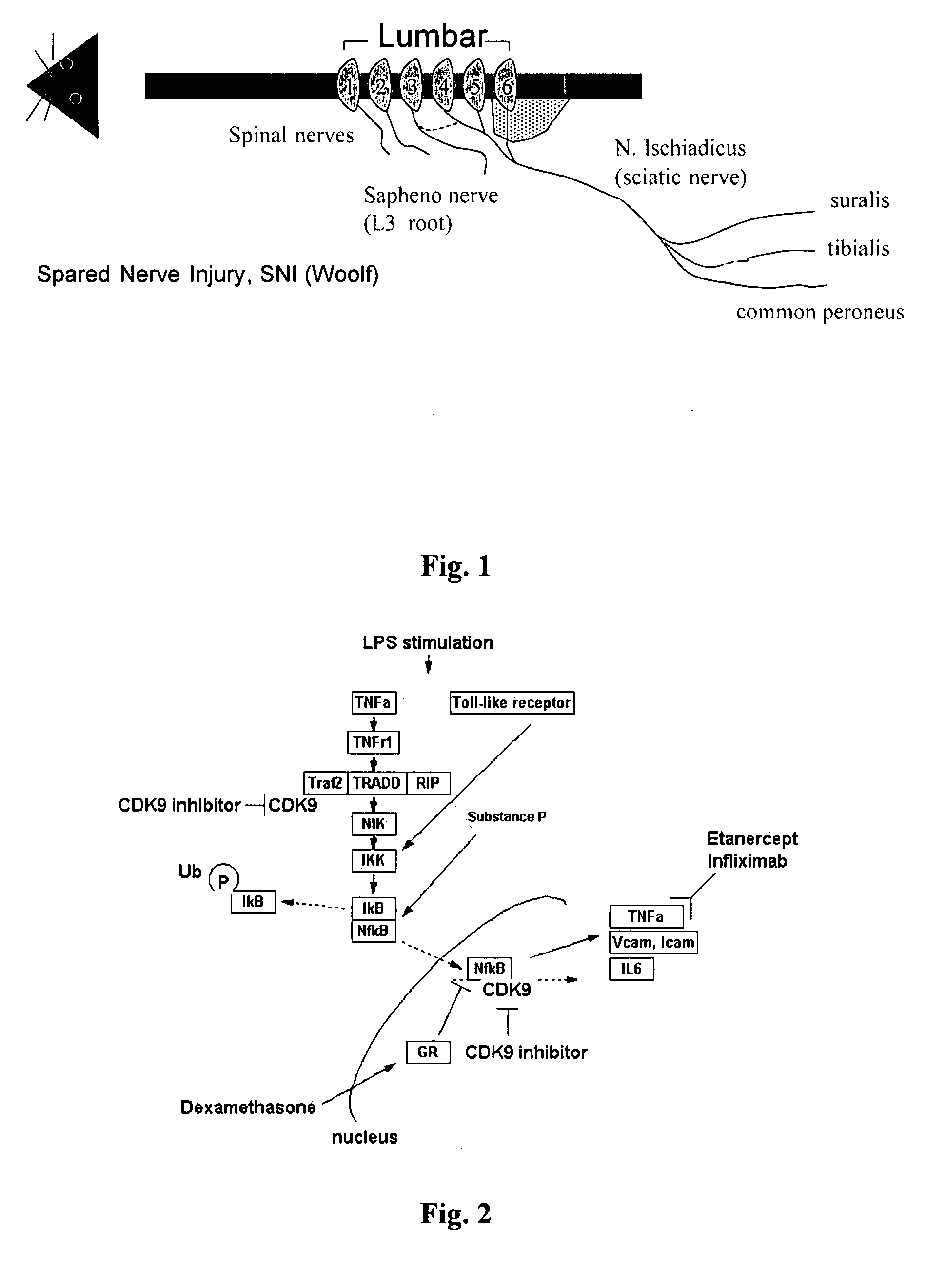 Methods of treating pain