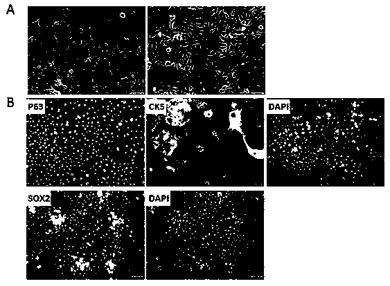 A method for isolating and culturing esophageal epithelial stem cells