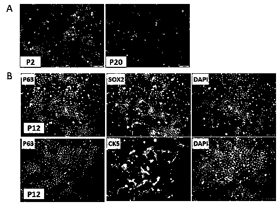 A method for isolating and culturing esophageal epithelial stem cells