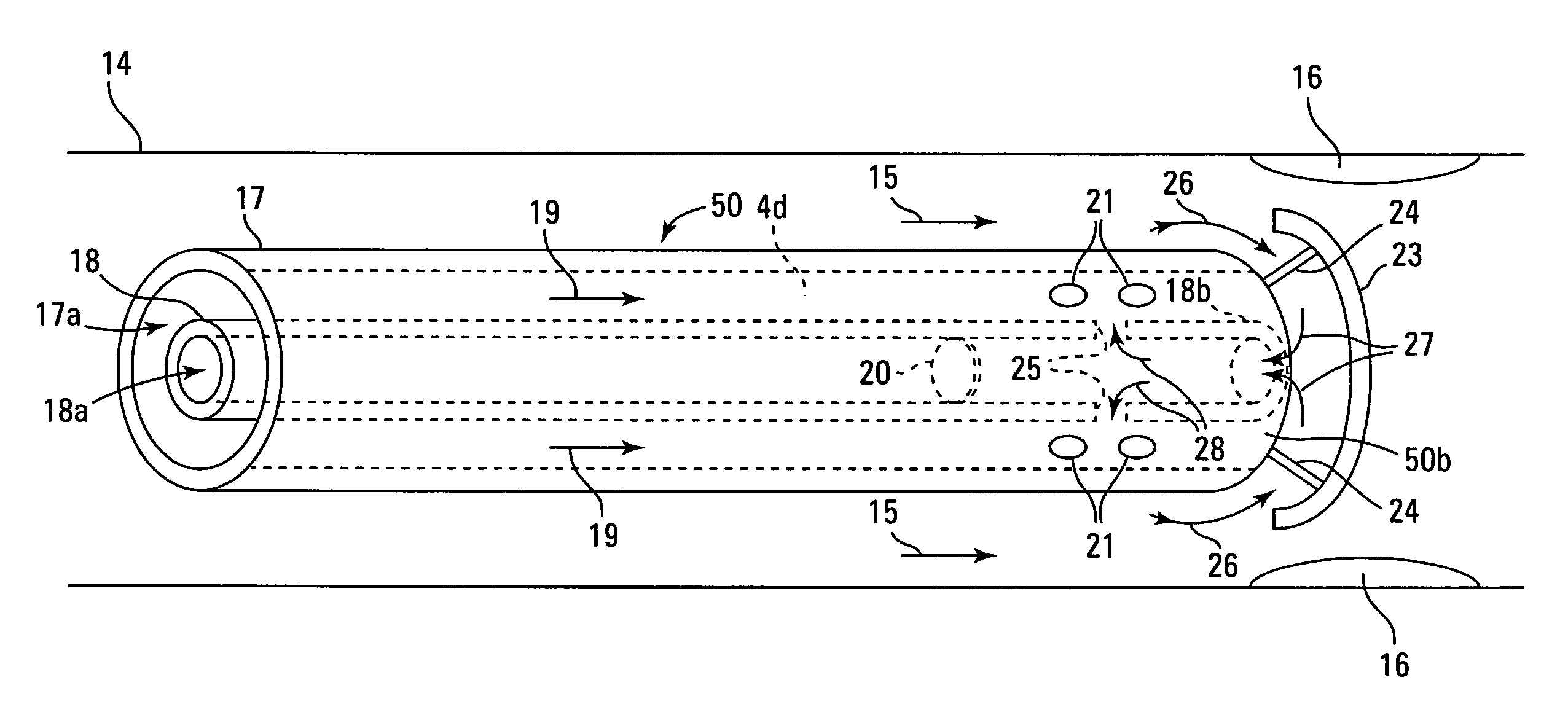 Catheter systems for delivery of agents and related method thereof