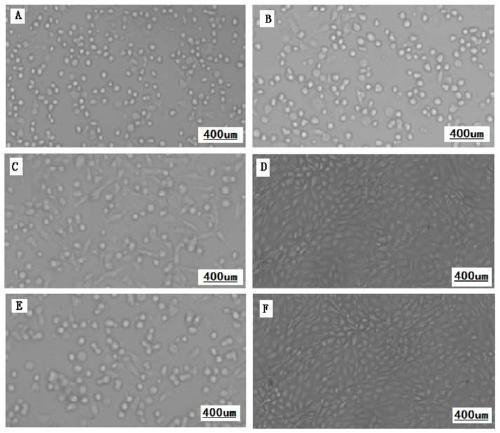 A natural passage cell line of lamb testis Sertoli cells and its application in the isolation, culture and propagation of sheep pox virus