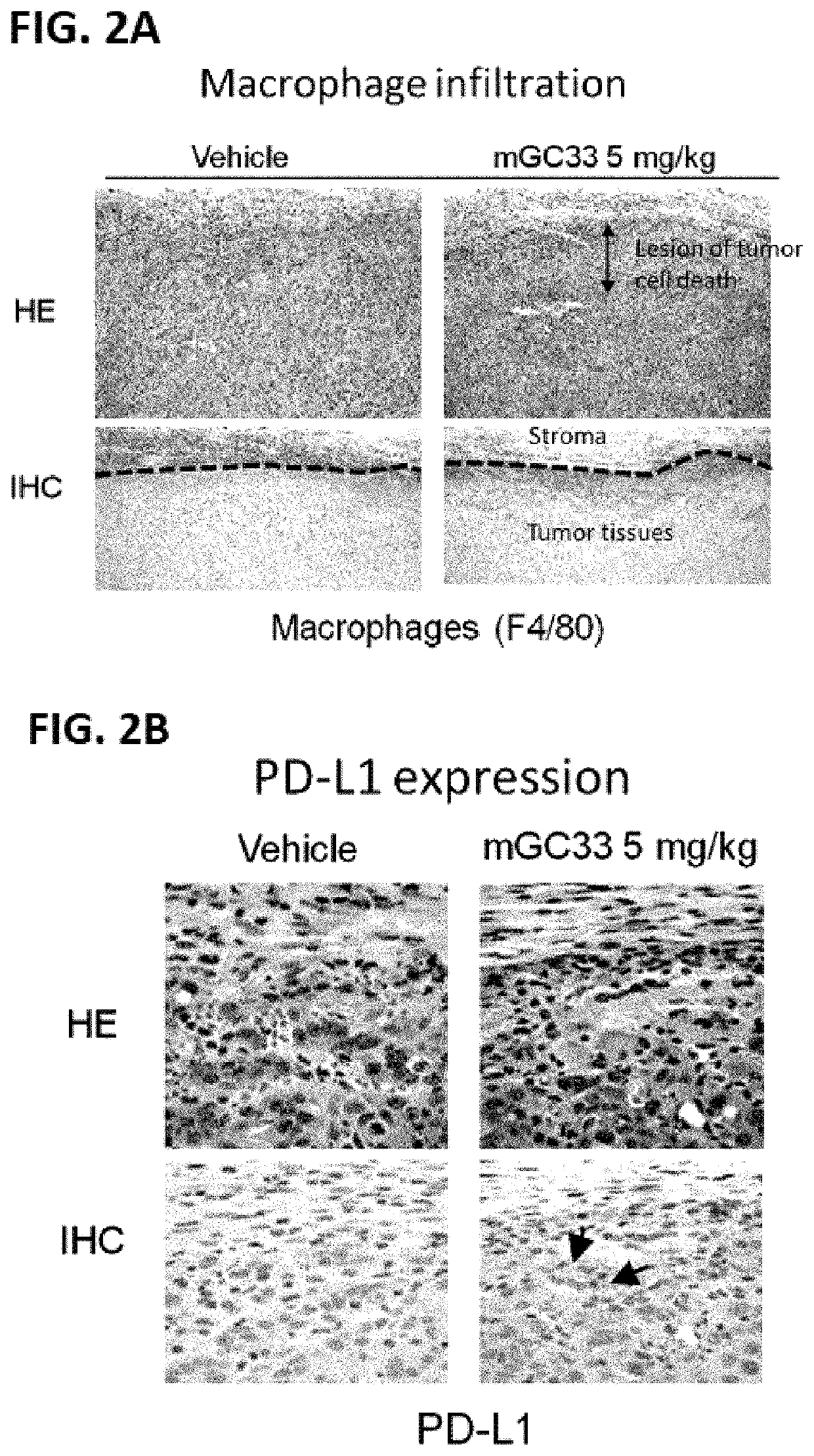 Dosage regimen for combination therapy using pd-1 axis binding antagonists and gpc3 targeting agent