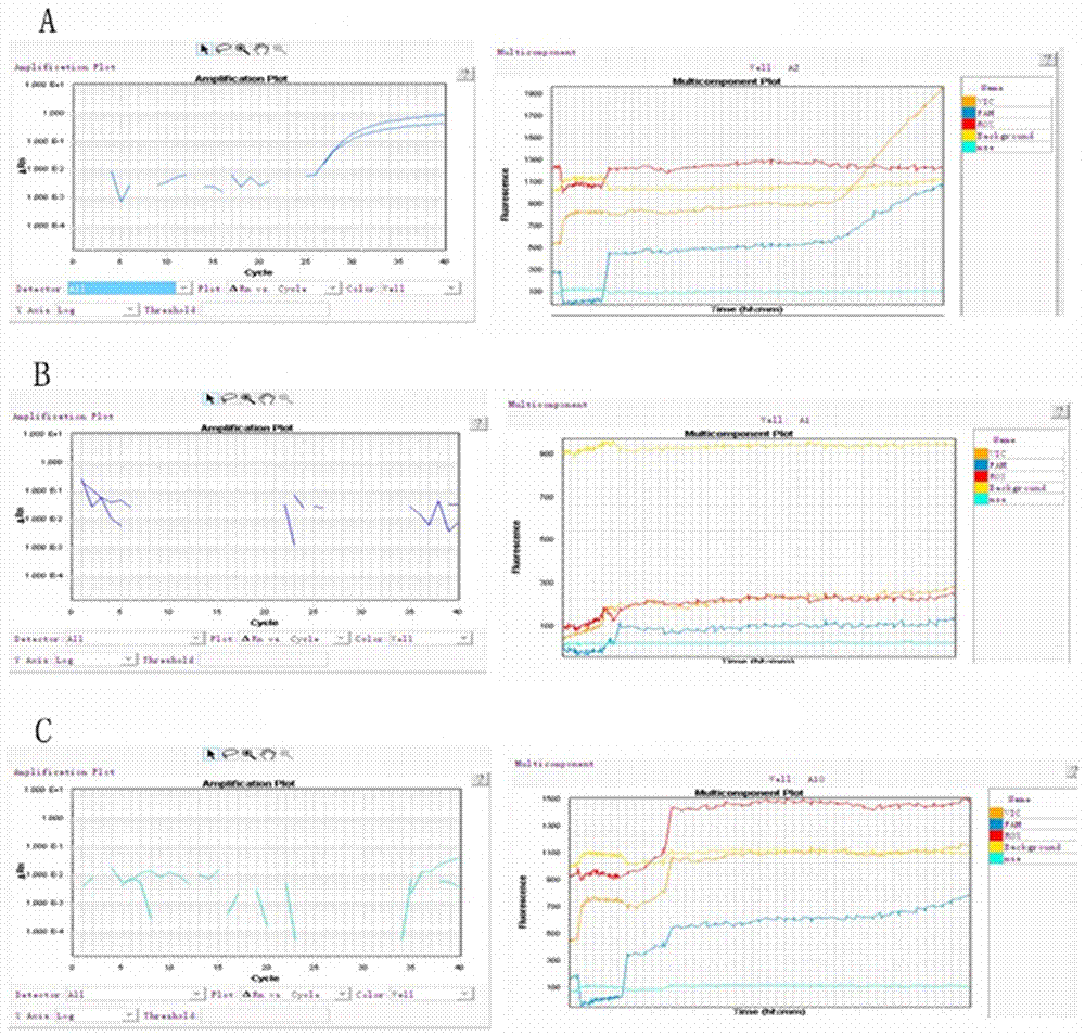 Primer group for detecting p.Pro189Ala site genotype as well as detection kit and application thereof