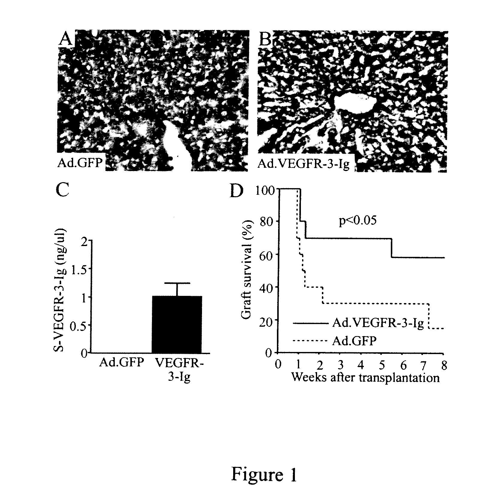 Growth factor antagonists for organ transplant alloimmunity and arteriosclerosis