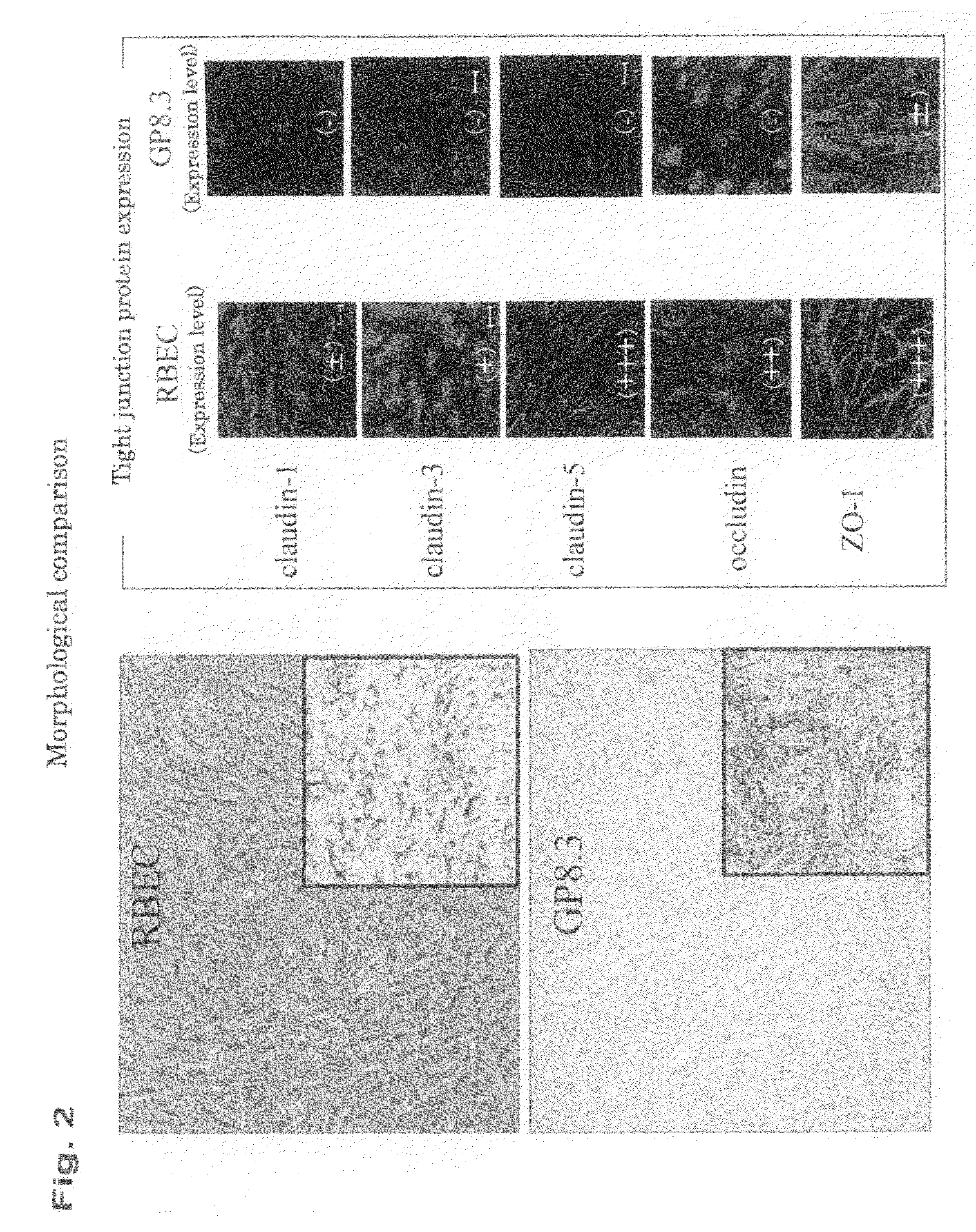 In-Vitro Model of Blood-Brain Barrier, In-Vitro Model of Diseased Blood-Brain Barrier, and Drug Screening Method, Analysis Method for Functions of Diseased Blood-Brain Barrier, and Analysis Method for Pathogenesis Using the Same