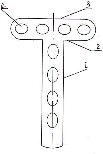 Tibial plateau back edge dissecting hook steel plate