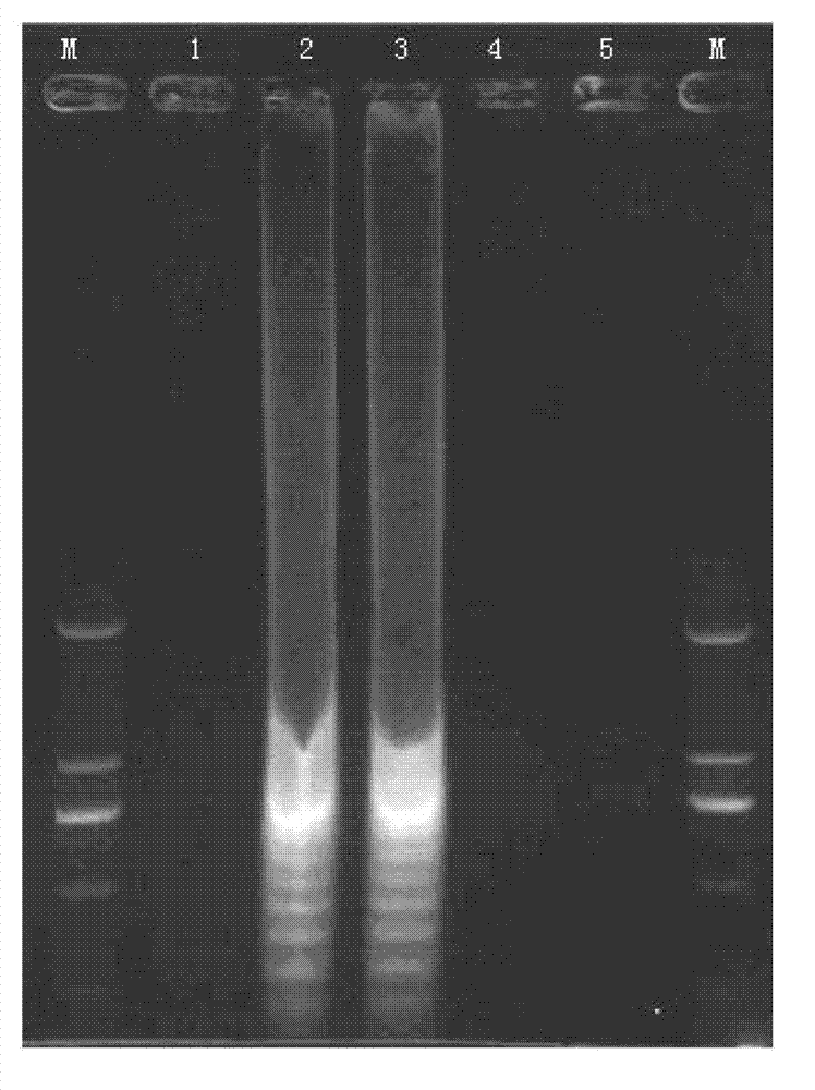 Reagent and method for detecting yellow fever virus