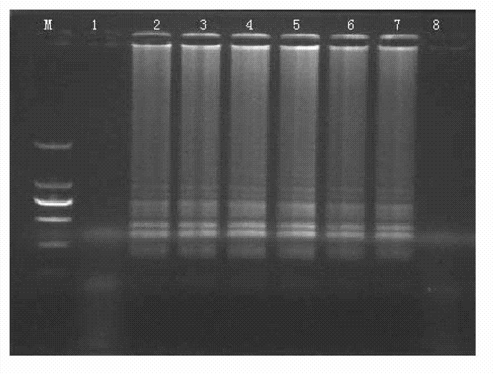 Reagent and method for detecting yellow fever virus