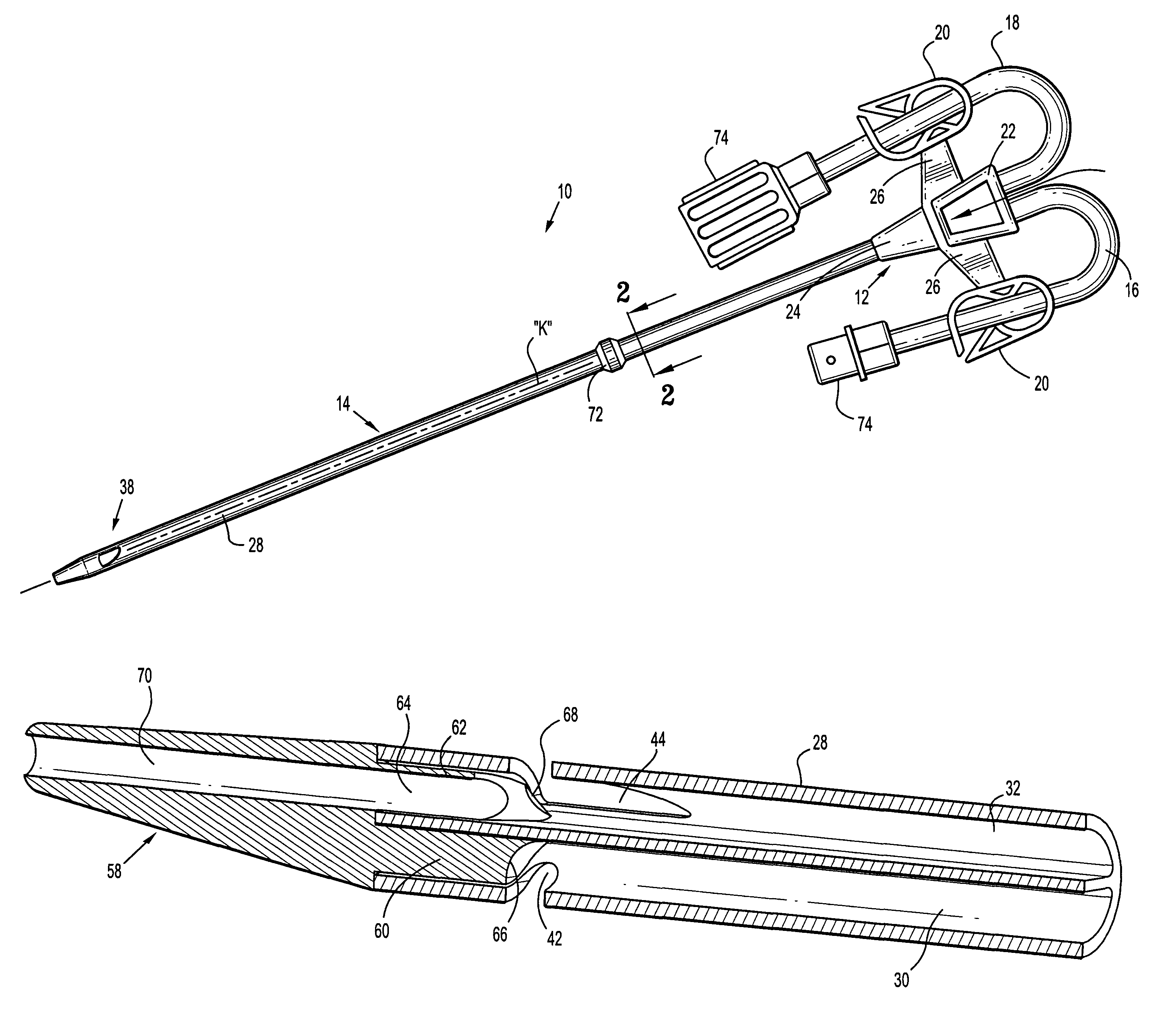 Acute hemodialysis catheter assembly