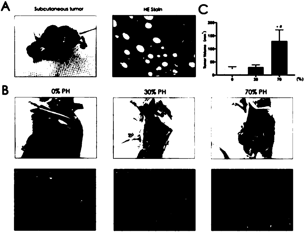 Method for promoting growth of mice liver implanted tumor after partial hepatectomy