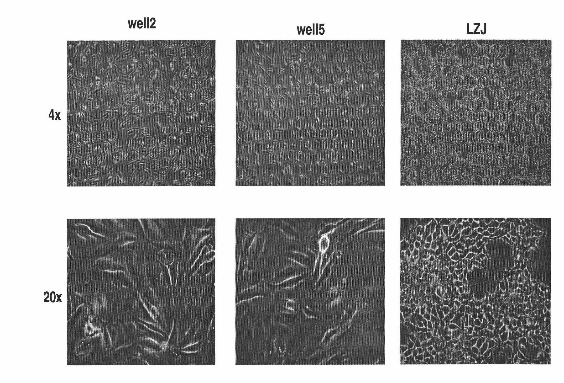 Human osteosarcoma cell line group and mouse in-vivo transplantation model