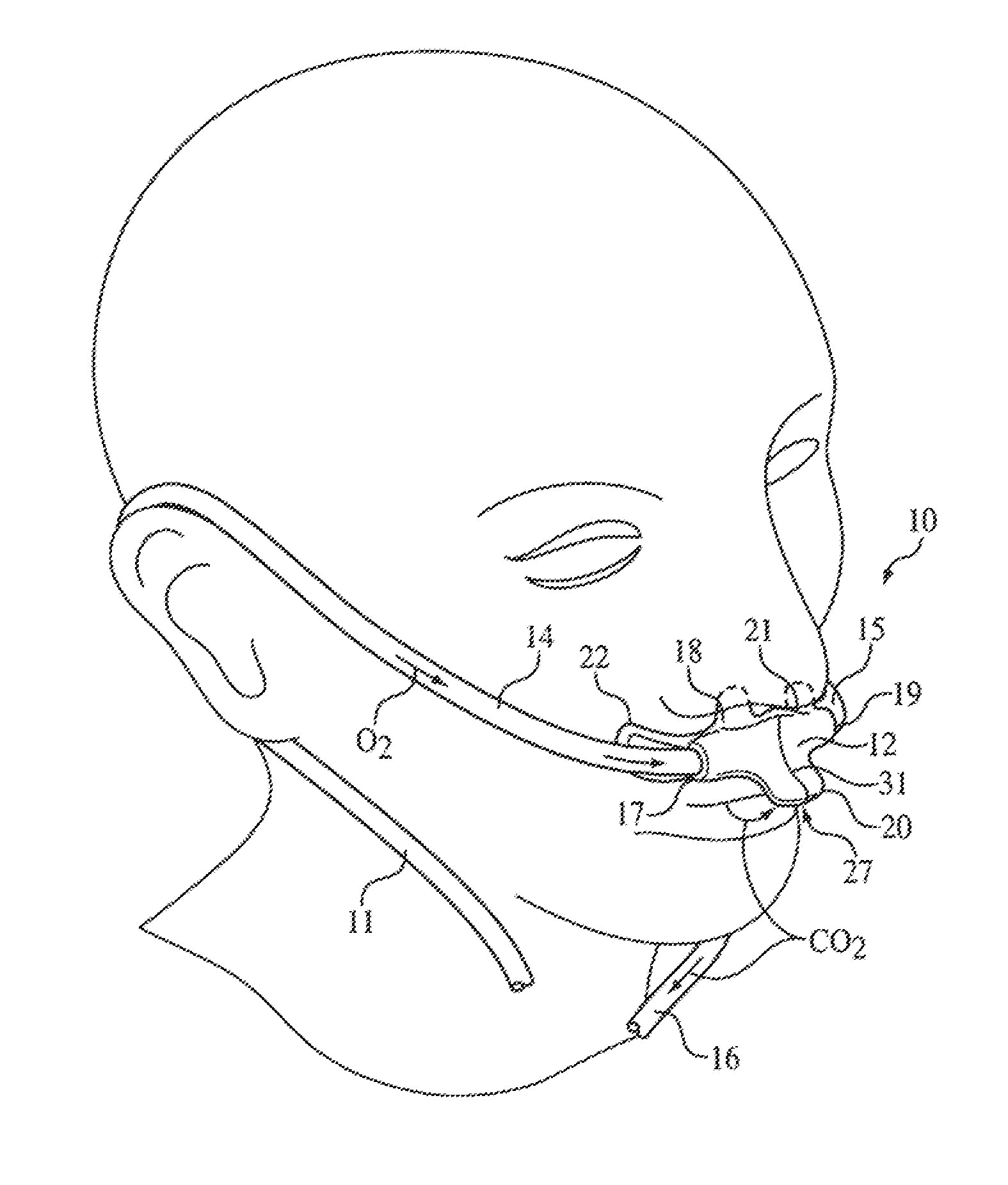 Nasal and oral patient interfaces