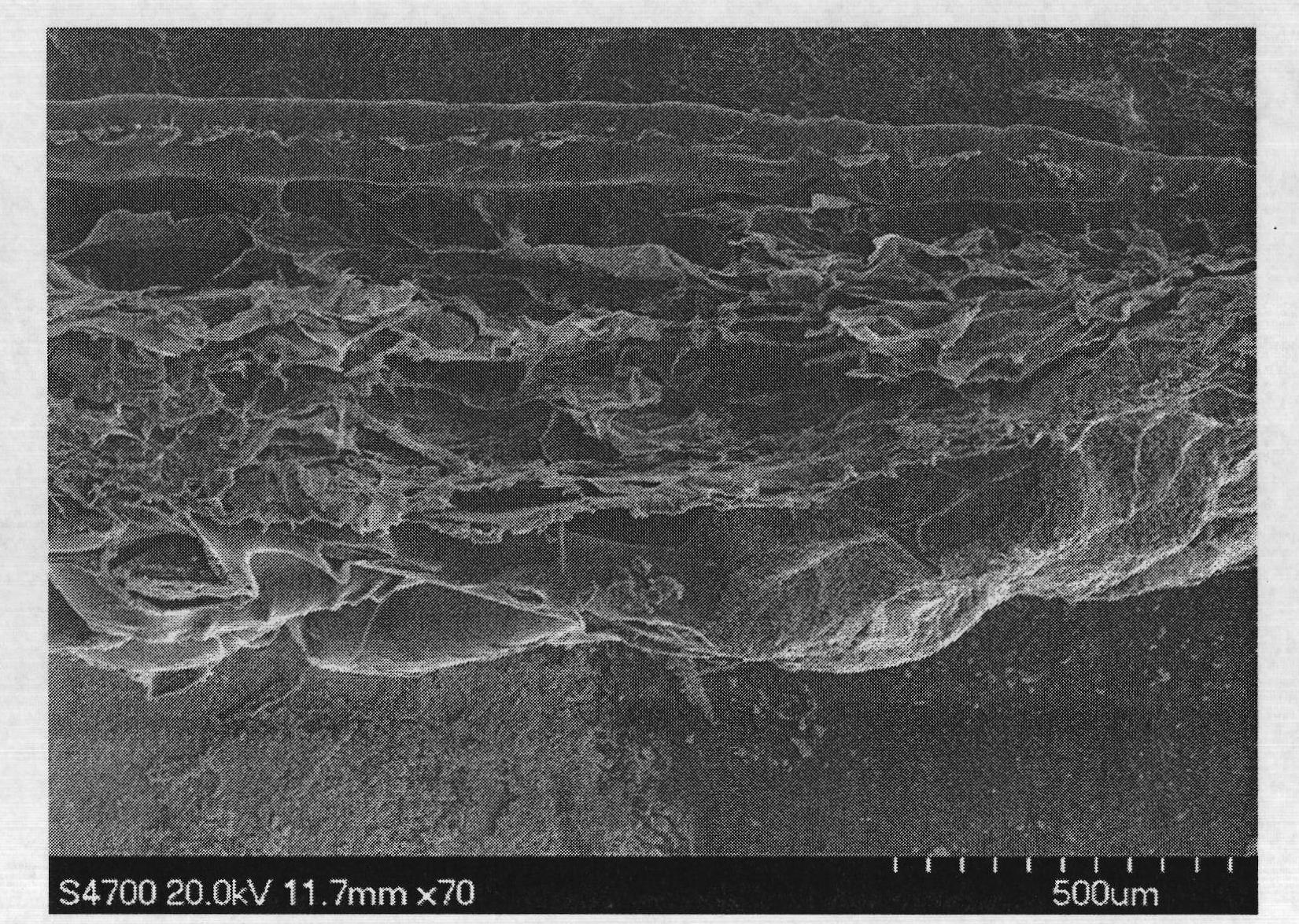 Multi-layer hernia repairing patch and preparation method thereof