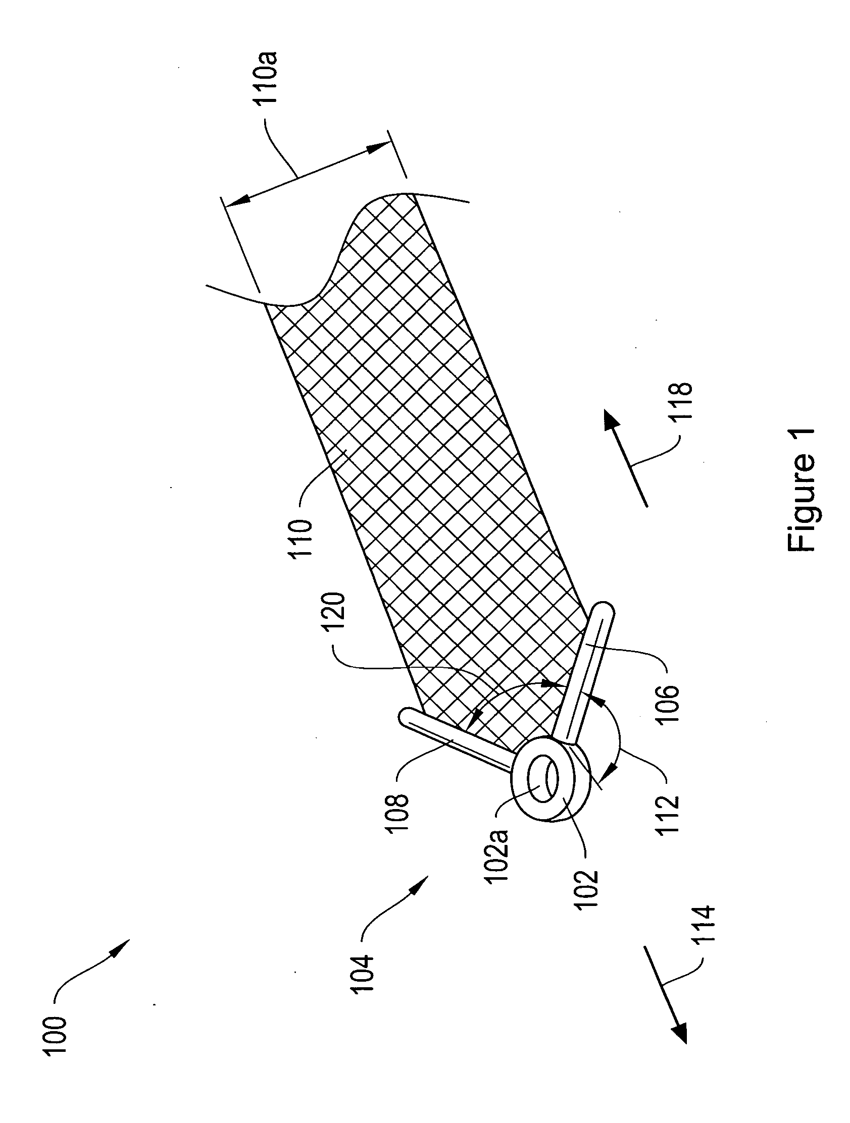 Pelvic floor repair system