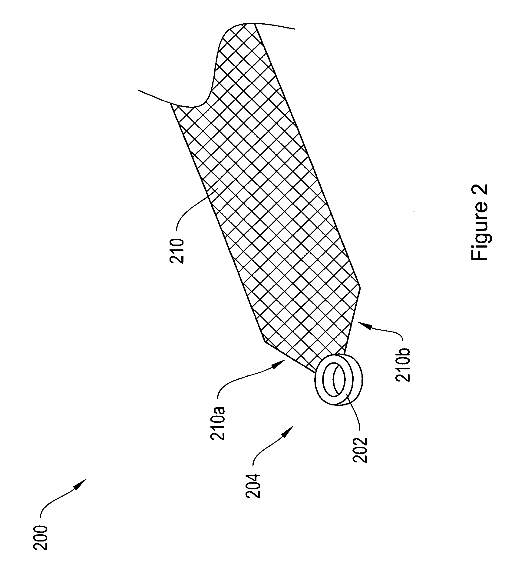 Pelvic floor repair system