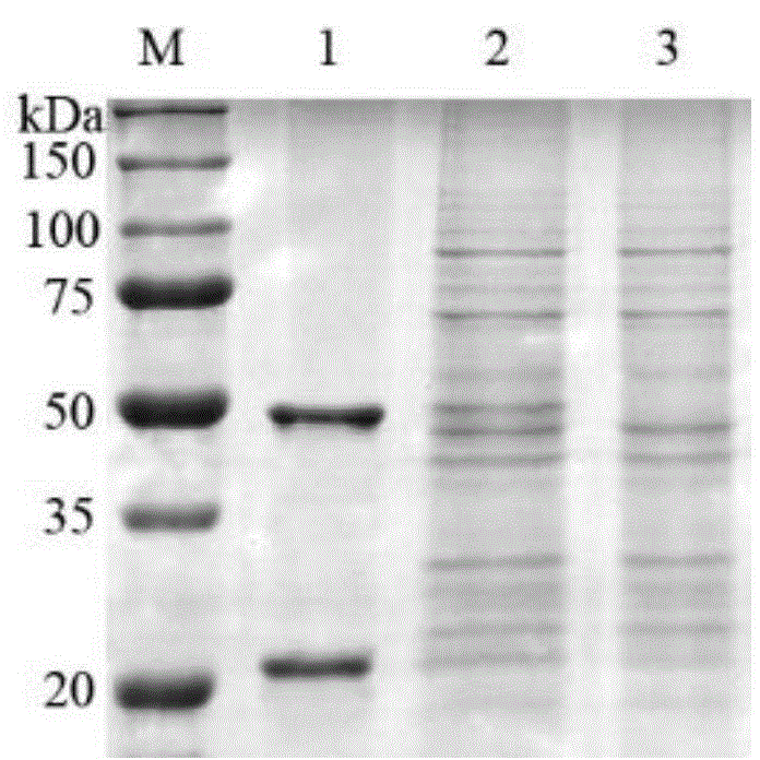 Human-derived antibody IgG of anti-anthrax protective antigen PA and application of human-derived antibody IgG