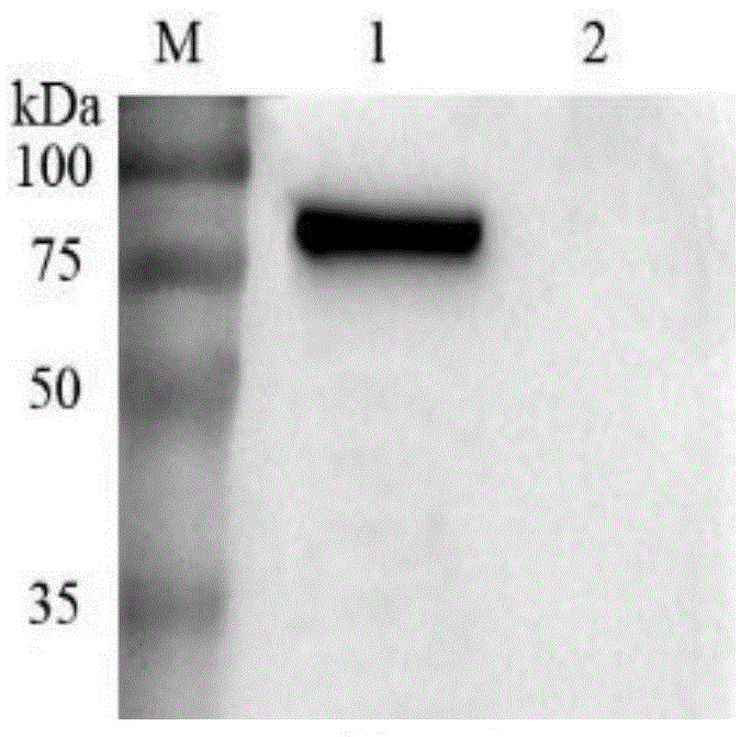 Human-derived antibody IgG of anti-anthrax protective antigen PA and application of human-derived antibody IgG