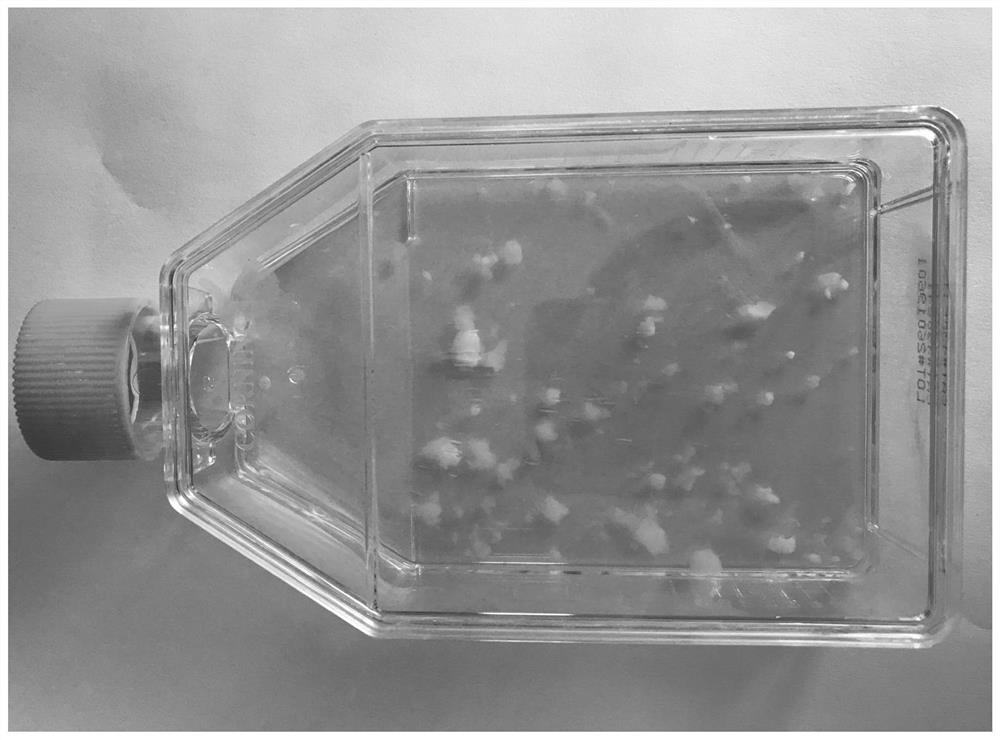 Isolated culture method of human umbilical cord mesenchymal stem cells