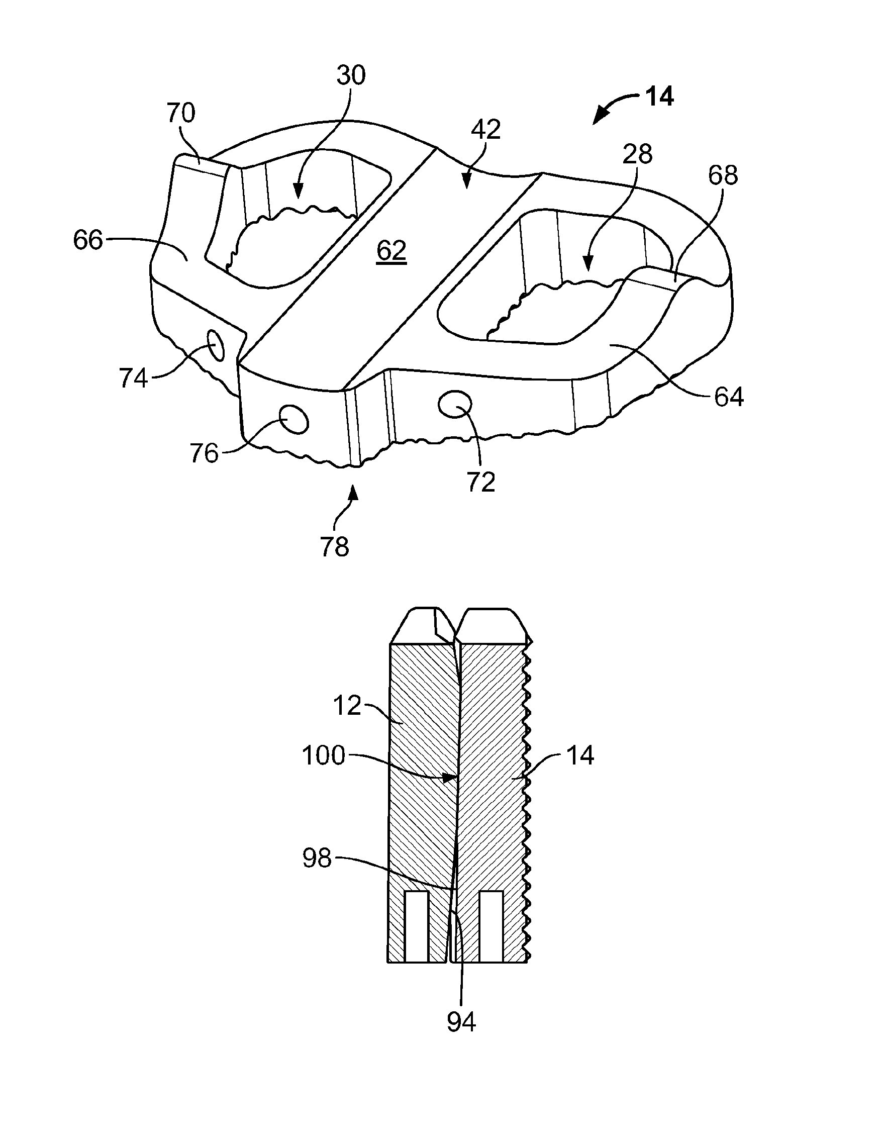 Spinal implant, instrument for preparation and method of use