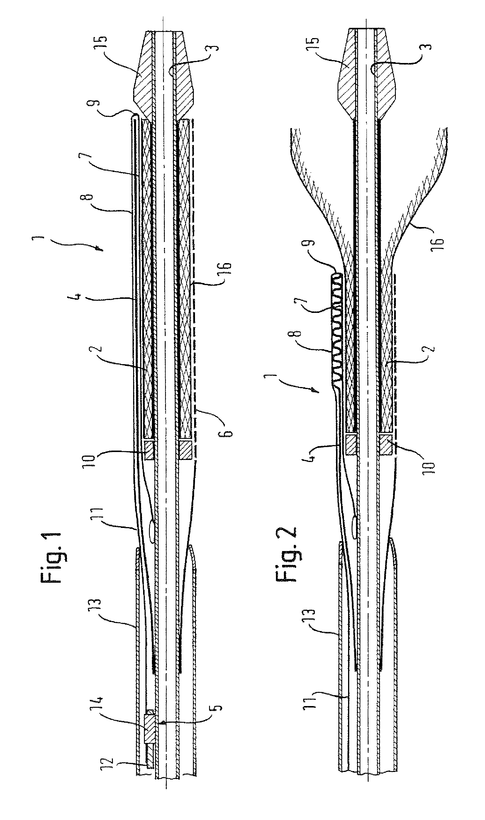 Stent delivery device