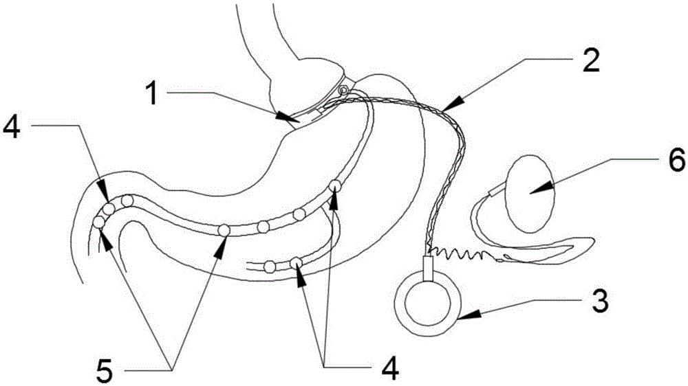 Gastric banding and gastrointestinal electrical stimulation combined device for treating obesity and application method thereof