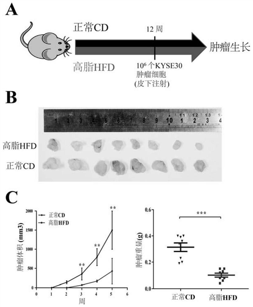 Application of lncRNA SLC25A21-AS1 as marker of esophageal squamous cell carcinoma