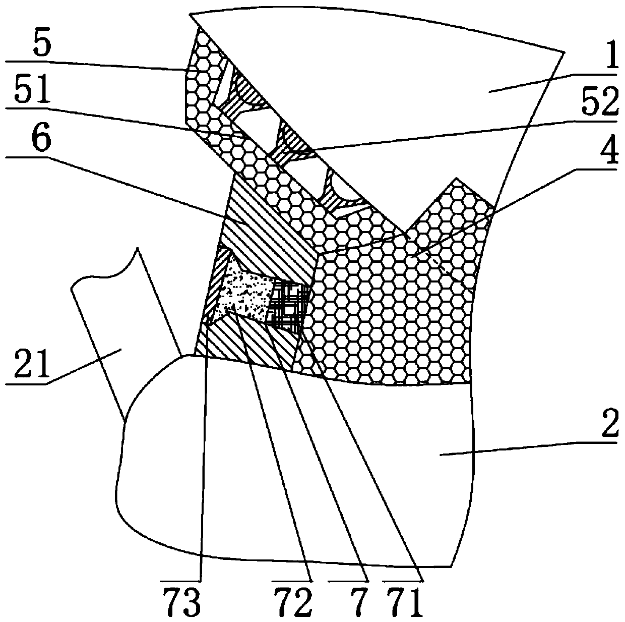 Medical anti-falling and anti-infection goggles