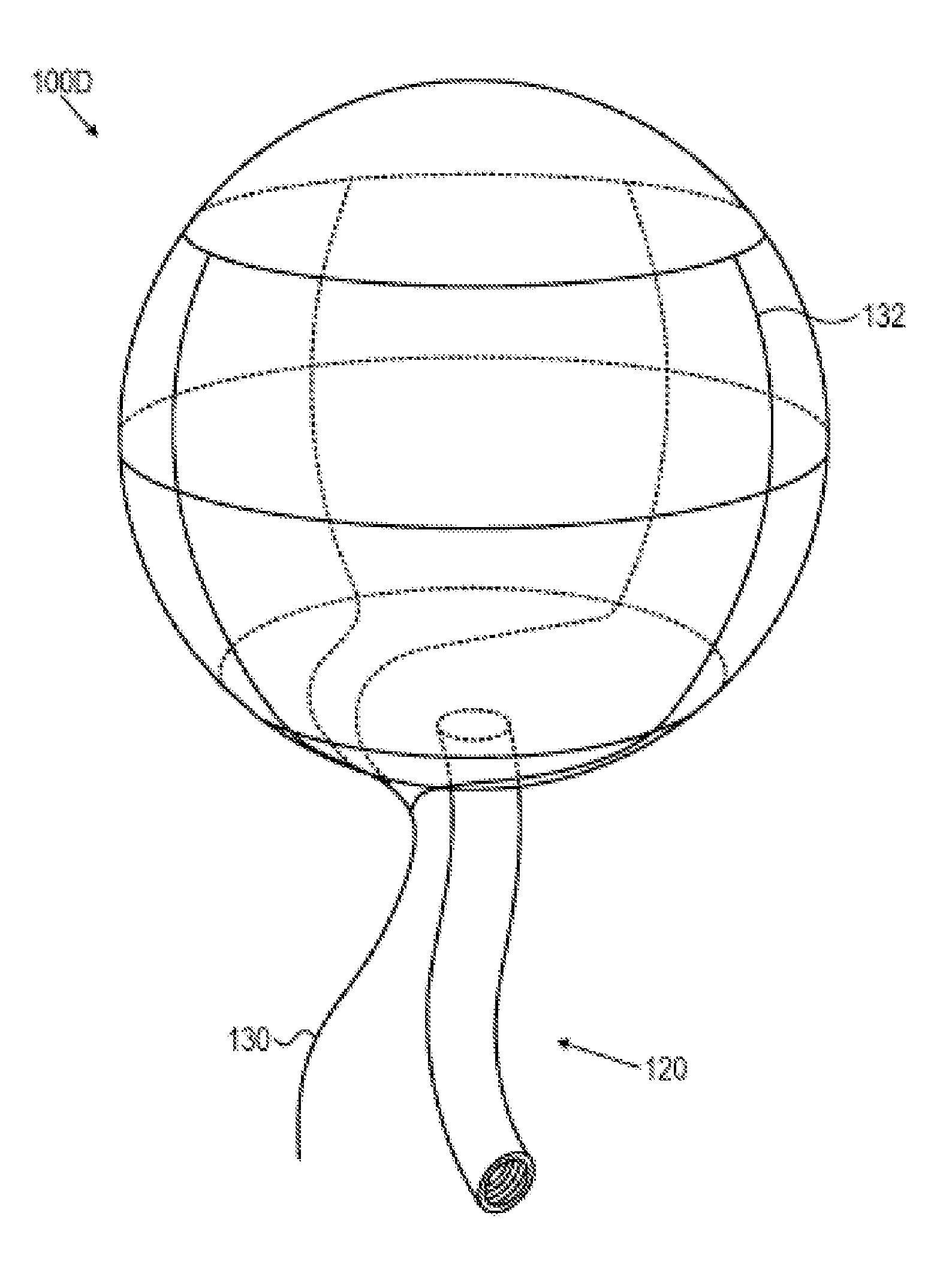 Bladder tissue modification for overactive bladder disorders