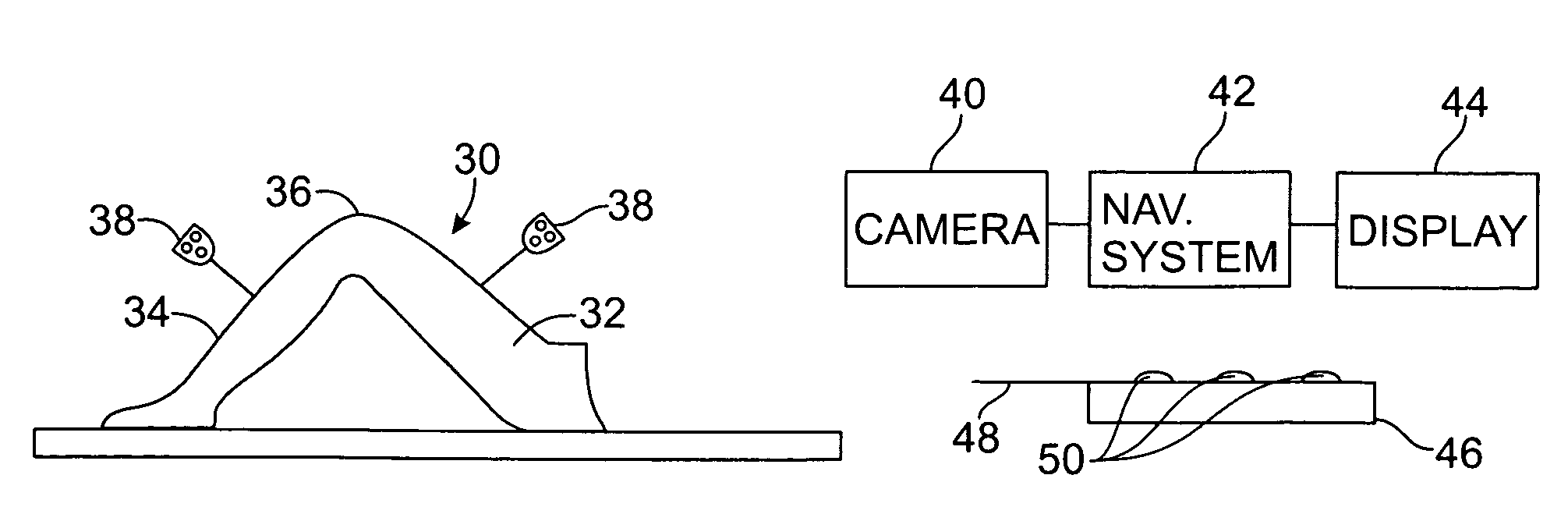 Method of and system for planning a surgery