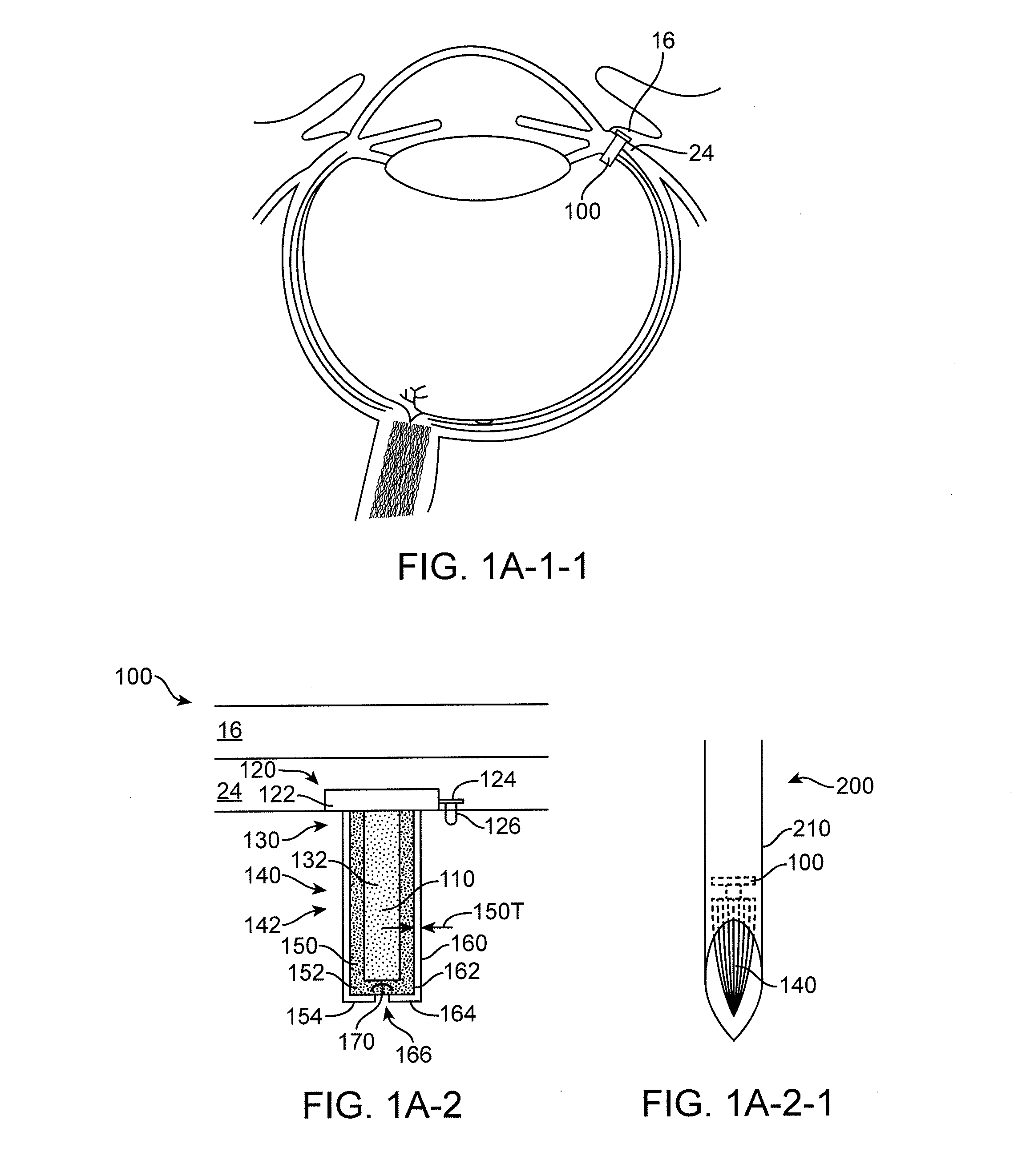 Implantable therapeutic device