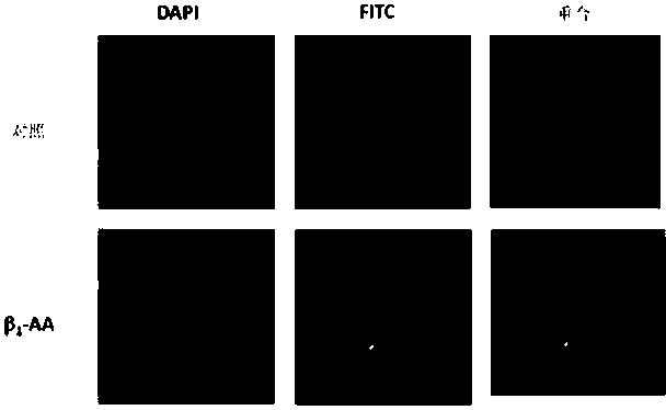 Beta-1 adrenergic receptor monoclonal antibody for inducing myocardial cell apoptosis