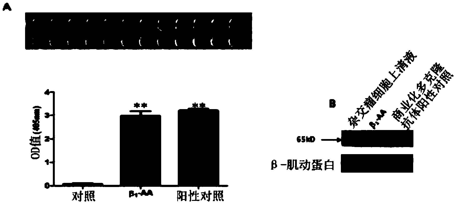 Beta-1 adrenergic receptor monoclonal antibody for inducing myocardial cell apoptosis