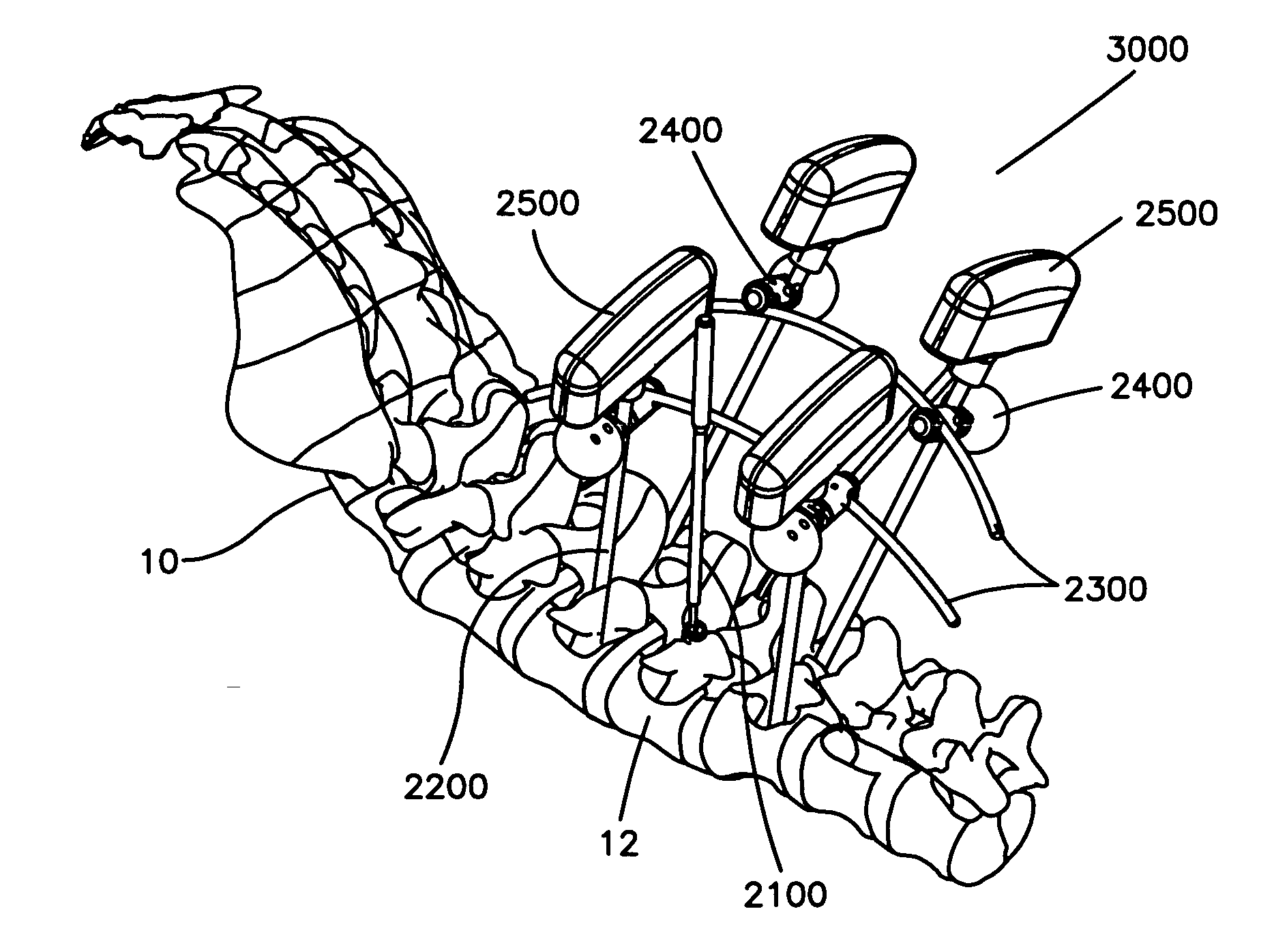 Apparatus and methods for vertebral augmentation