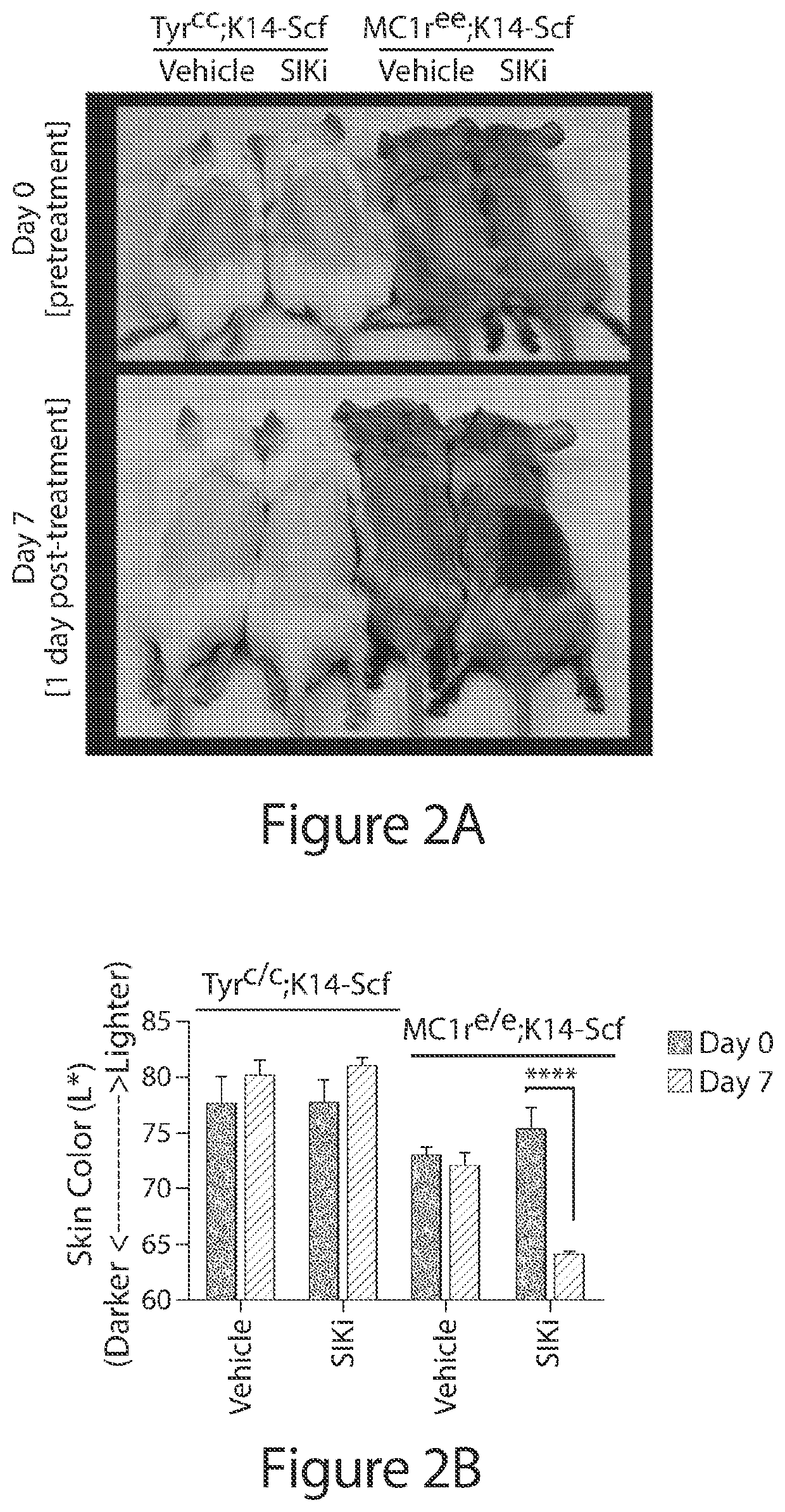 Uses of pyrimidopyrimidinones as sik inhibitors