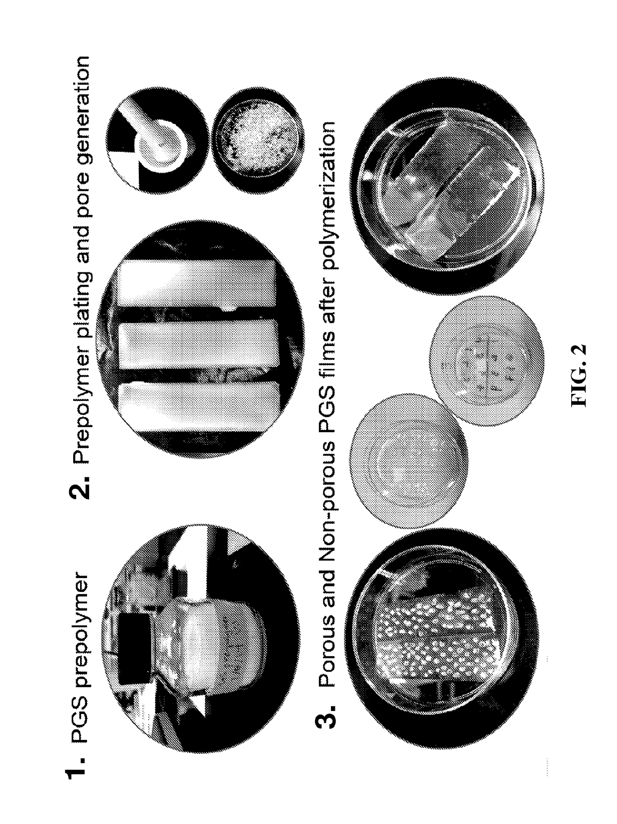 Synthesis and use of poly(glycerol-sebacate) films in fibroblast growth regulation