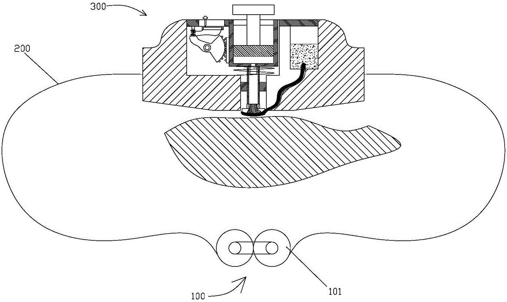 Cardiology department operation hemostasis device