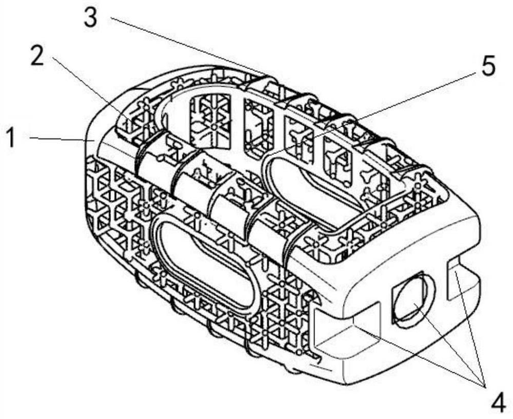 3D printing porous interbody fusion cage