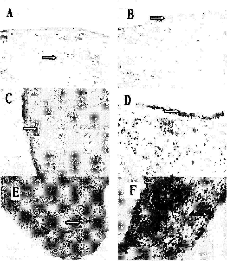 Monoclonal antibody (hybrid tumor) for neutralizing CYR61 and applications thereof