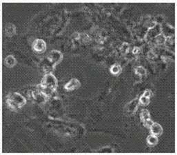 A kind of rapid separation method of aphthous ulcer virus