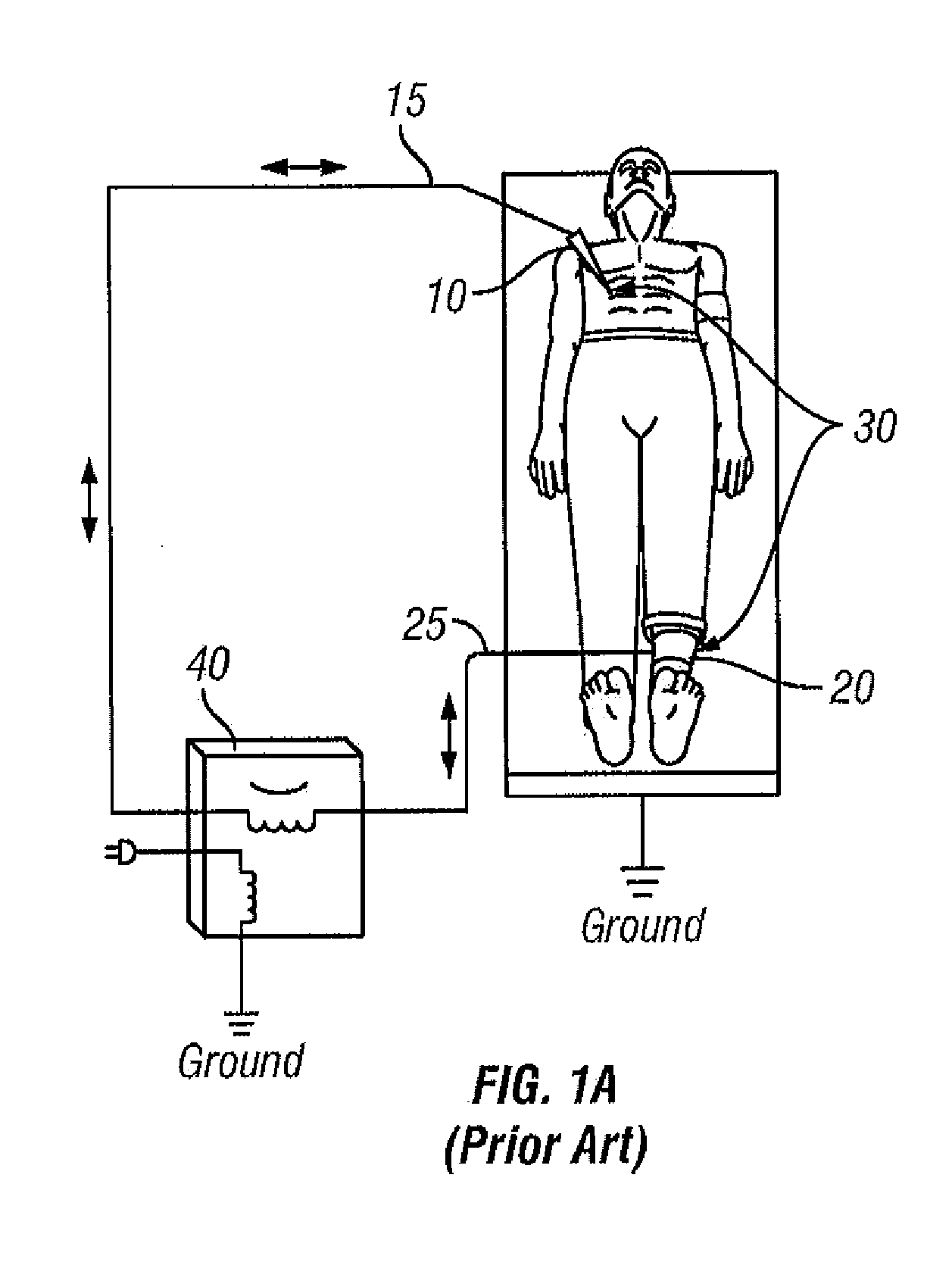 Active conversion of a monopolar circuit to a bipolar circuit using impedance feedback balancing