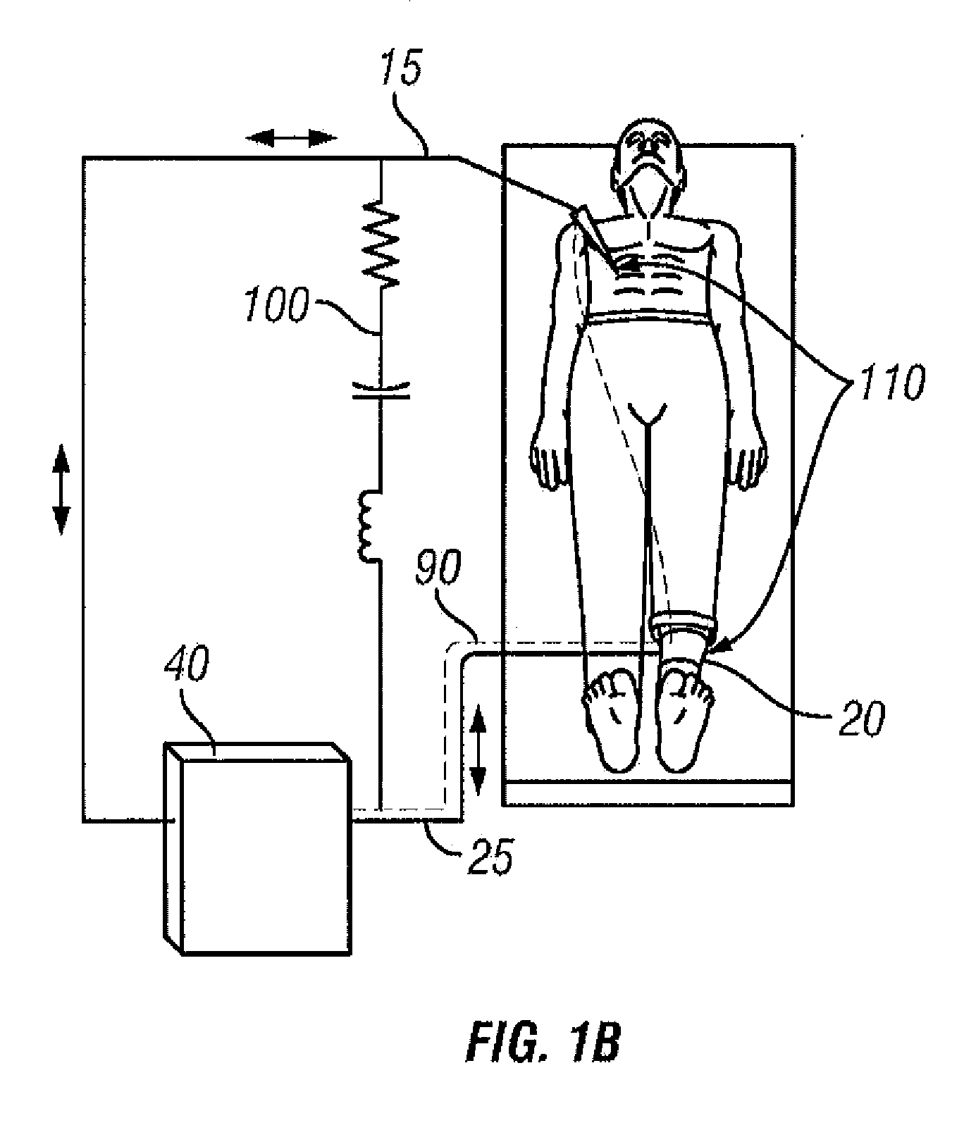 Active conversion of a monopolar circuit to a bipolar circuit using impedance feedback balancing